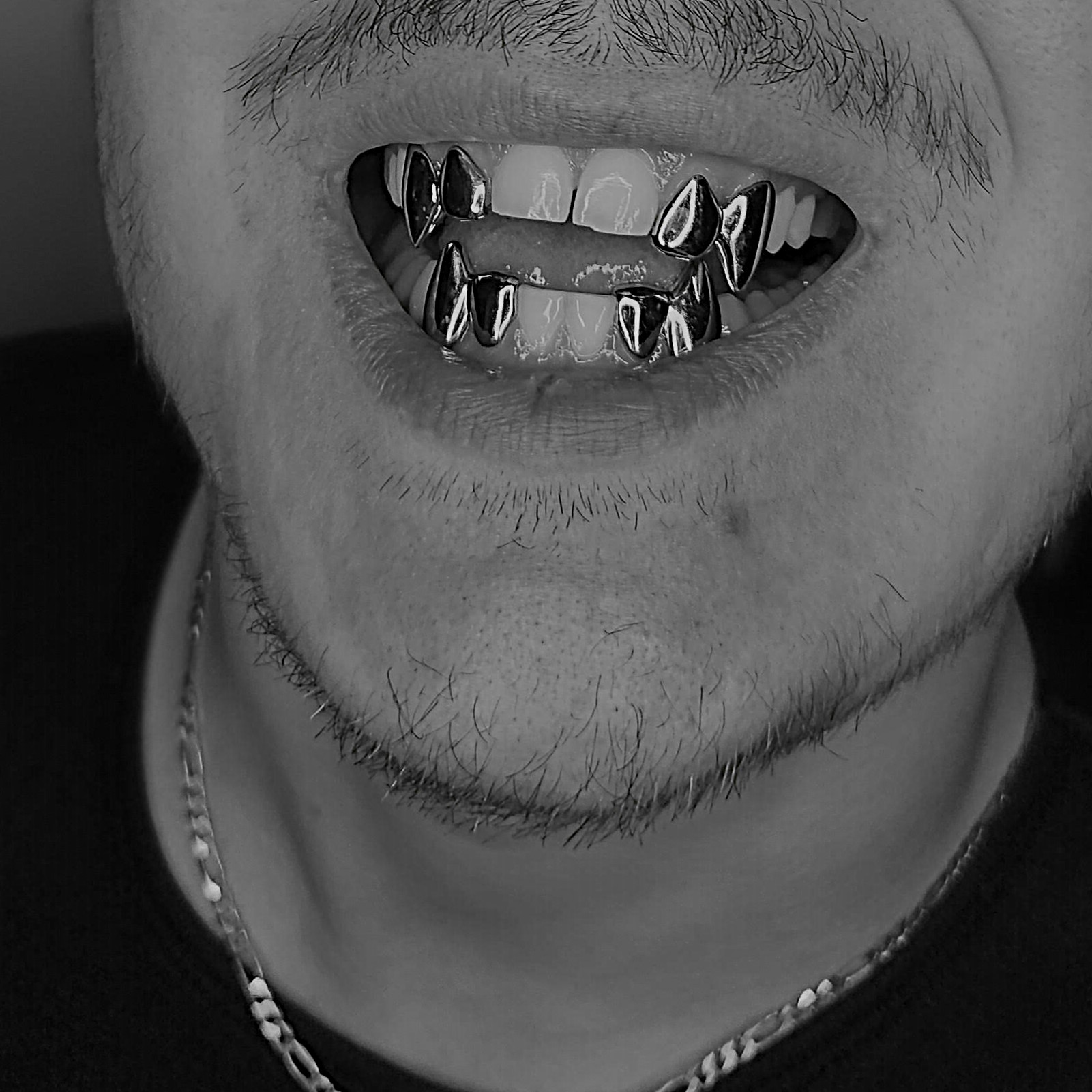 Fabrication de grillz